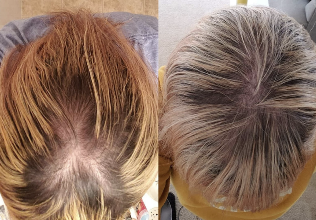 Revitalize Hair with Zenagen: See Results in Weeks